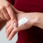 Los Mejores Remedios Curativos para Combatir las quemaduras